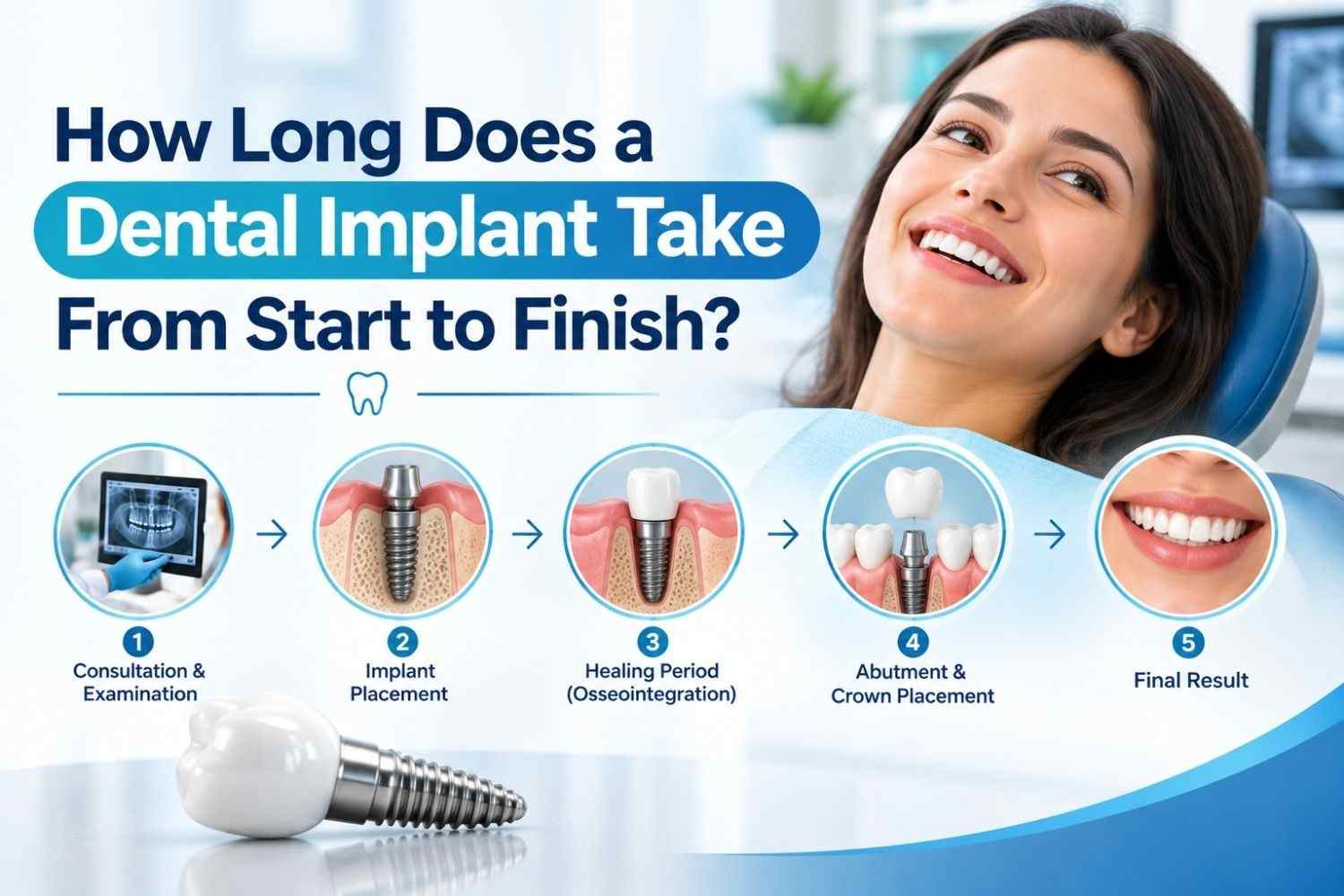 Dental implant treatment timeline from implant placement to final crown