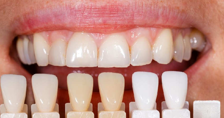 expert-tmj-disorder-treatment-in-paschim-vihar2